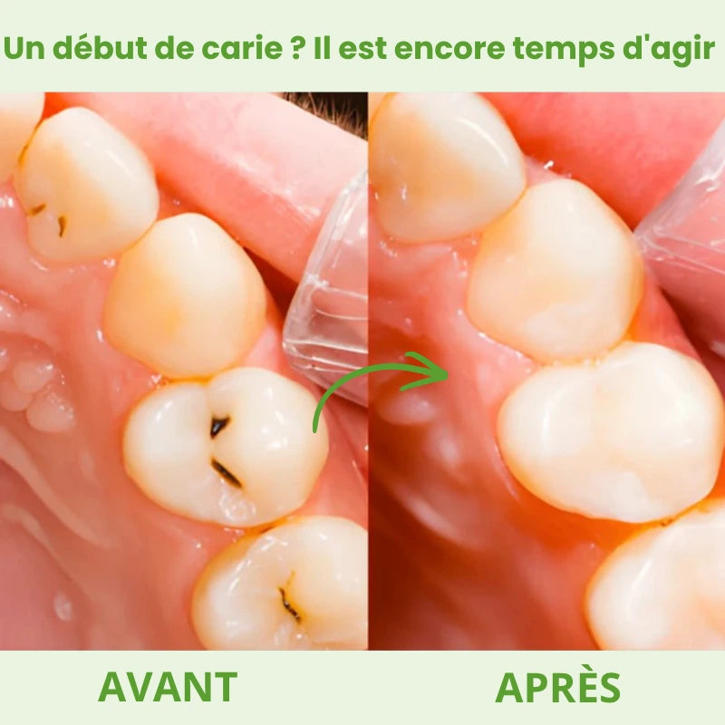 Dentaru Gomme Anti-Caries Naturelle