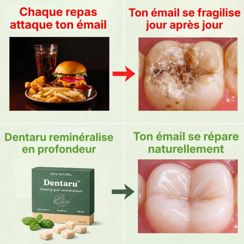 Dentaru Gomme Anti-Caries Naturelle