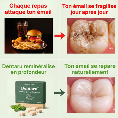 Dentaru Gomme Anti-Caries Naturelle